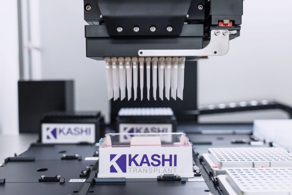 HLA & Transplant | Kashi Clinical Laboratories